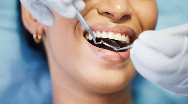 Best Emergency Tooth Extraction in Johnston City, IL